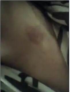 怎么才能种草莓在女孩的脖子上
